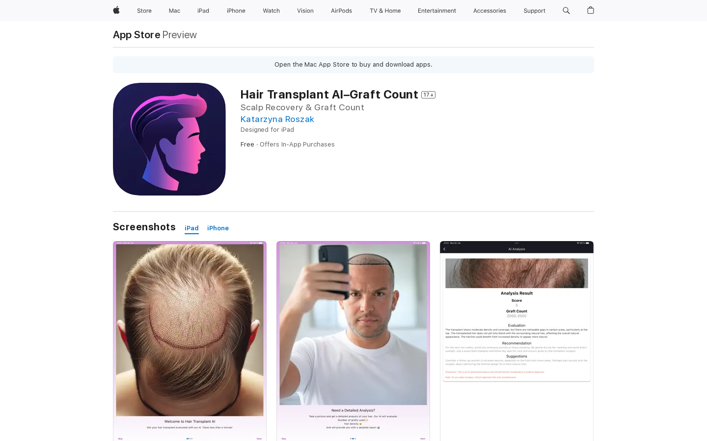 Show HN: Hair Transplant Analysis with AI - Project Screenshot